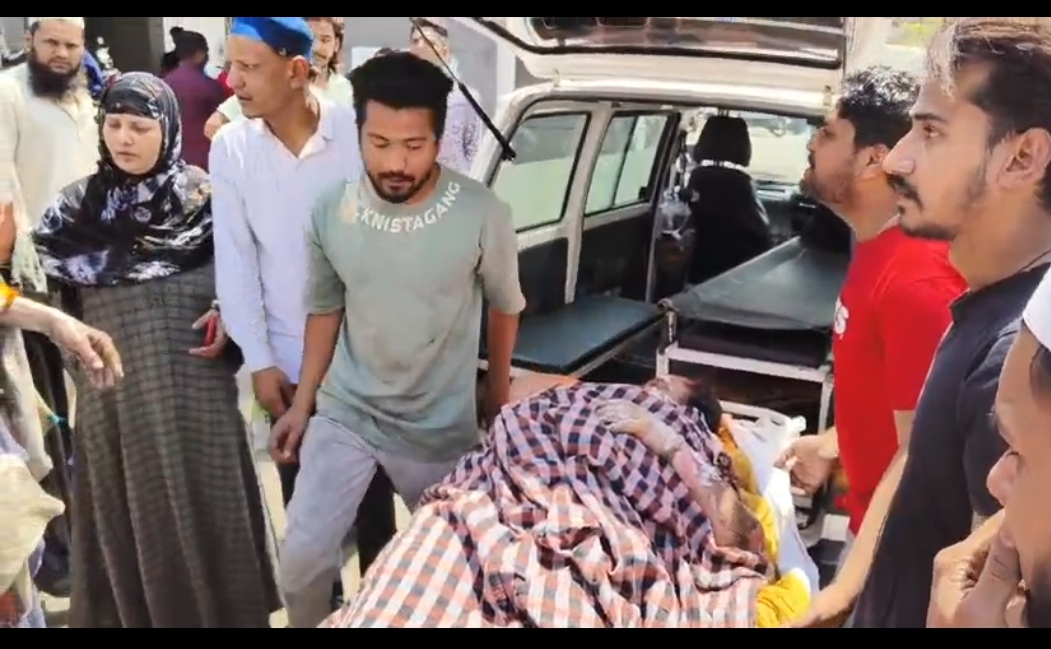 अलंकार मार्केट में  मकान में लगी आग, एक महिला और दो पुरुष झुलसे, मामला स…